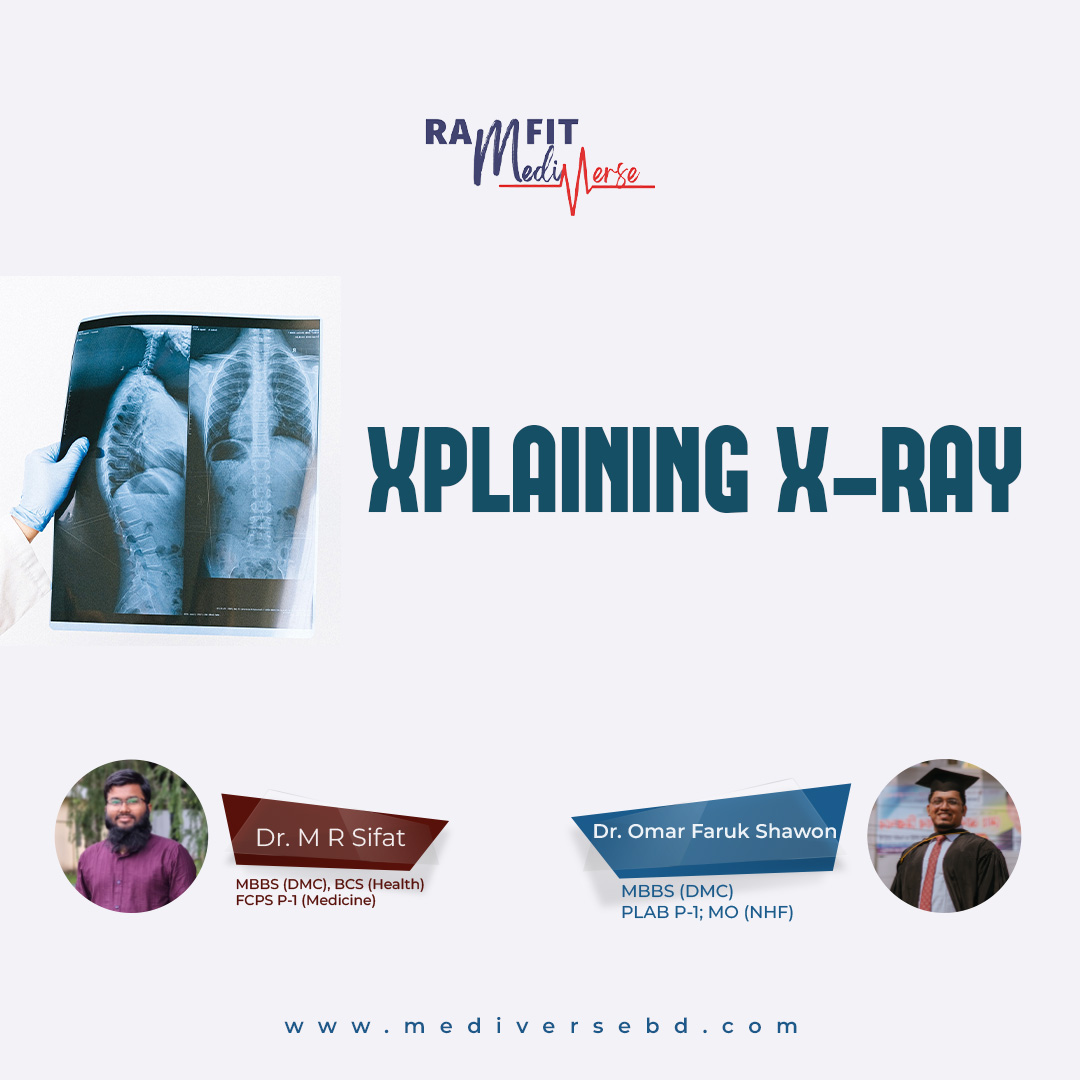 Xplaining X-ray 